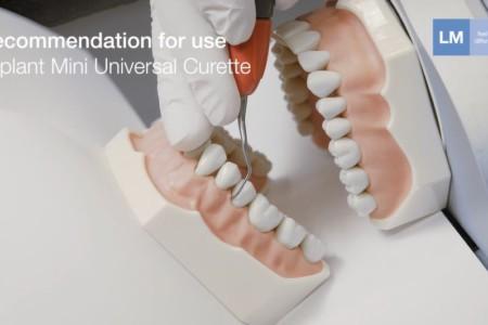 Video thumbnail of How to Use video for Mini Universal Curette