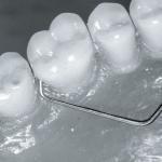 Sond, centrerad 9-17C